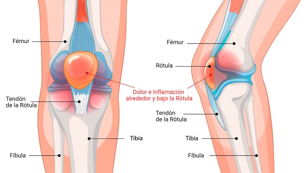 Anatomía de la rodilla